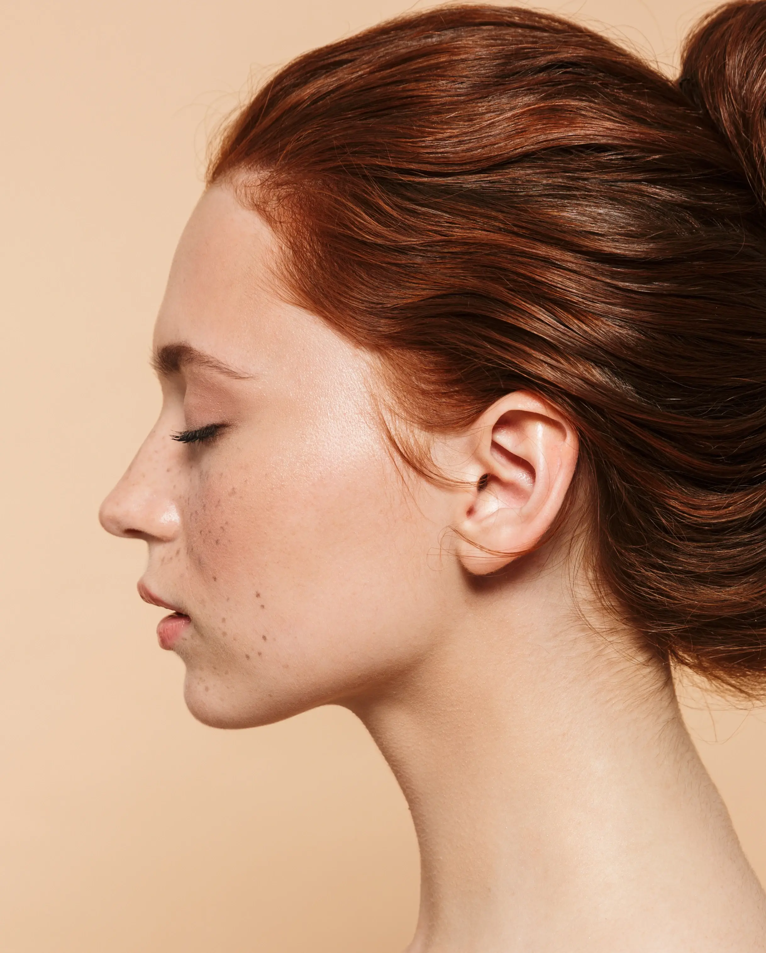 Ultherapy | aesthetics Pallas Kliniken Ultherapy
